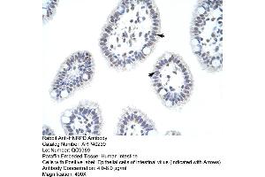 Rabbit Anti-HNRPD Antibody  Paraffin Embedded Tissue: Human Intestine Cellular Data: Epithelial cells of intestinal villas Antibody Concentration: 4. (HNRNPD/AUF1 Antikörper  (N-Term))