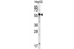 Western Blotting (WB) image for anti-Matrix Metalloproteinase 20 (MMP20) antibody (ABIN3002549) (MMP20 Antikörper)