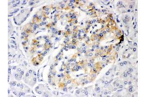 ISG15 was detected in paraffin-embedded sections of human pancreatic cancer tissues using rabbit anti- ISG15 Antigen Affinity purified polyclonal antibody (Catalog # ) at 1 µg/mL. (ISG15 Antikörper  (AA 2-157))