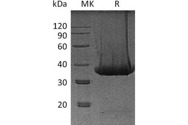 Kallikrein 1 Protein (KLK1) (His tag)