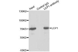 Immunoprecipitation analysis of 150ug extracts of Jurkat cells using 3ug LCP1 antibody. (LCP1 Antikörper  (AA 1-270))