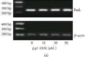 Effects of different p,p'-DDE concentrations on the FasL and caspase-3 and -8 mRNA in rat Sertoli cells by RT-PCR (a)-(c). (FASL Antikörper  (AA 196-281))