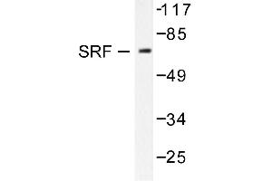 Image no. 1 for anti-Serum Response Factor (SRF) antibody (ABIN271823) (SRF Antikörper)