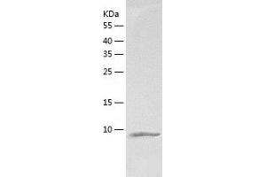 Western Blotting (WB) image for Chemokine (C-C Motif) Ligand 24 (CCL24) (AA 23-119) protein (His tag) (ABIN7122290)