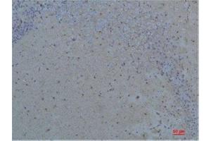 Immunohistochemistry (IHC) analysis of paraffin-embedded Rat Brain Tissue using S100 beta Rabbit Polyclonal Antibody diluted at 1:200. (S100B Antikörper)