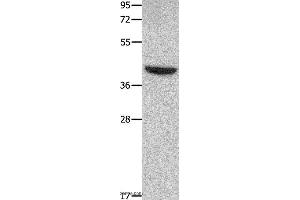 Western blot analysis of Mouse heart tissue, using MMP28 Polyclonal Antibody at dilution of 1:350 (MMP28 Antikörper)