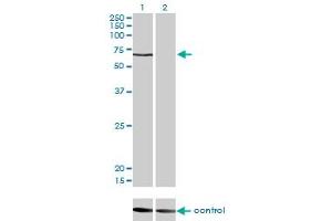 Western blot analysis of CACNB1 over-expressed 293 cell line, cotransfected with CACNB1 Validated Chimera RNAi (Lane 2) or non-transfected control (Lane 1). (CACNB1 Antikörper  (AA 500-598))