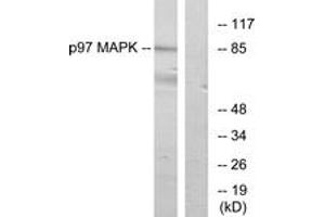 Western blot analysis of extracts from K562 cells, using p97 MAPK Antibody. (MAPK6 Antikörper  (AA 461-510))