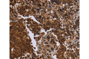 Immunohistochemistry (IHC) image for anti-Formin 2 (FMN2) antibody (ABIN5546665) (Formin 2 Antikörper)