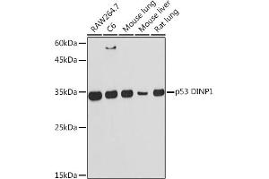 Western blot analysis of extracts of various cell lines, using p53 DINP1 Rabbit mAb (ABIN7271097) at 1:1000 dilution. (TP53INP1 Antikörper)