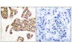 Immunohistochemistry (IHC) image for anti-BCL2-Associated Agonist of Cell Death (BAD) (pSer128), (pSer91) antibody (ABIN1847348)