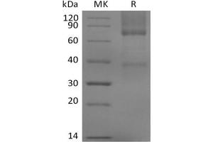 Western Blotting (WB) image for Glypican 3 (GPC3) protein (His tag) (ABIN7320888) (Glypican 3 Protein (GPC3) (His tag))