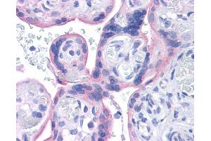INSR antibody was used for immunohistochemistry at a concentration of 4-8 ug/ml. (Insulin Receptor Antikörper  (Middle Region))
