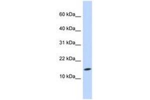 Image no. 1 for anti-Ubiquitin-Conjugating Enzyme E2D 3 (UBE2D3) (N-Term) antibody (ABIN6740793) (UBE2D3 Antikörper  (N-Term))