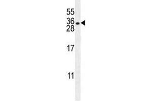 HLA-DQA1 antibody western blot analysis in NCI-H460 lysate. (HLA-DQA1 Antikörper  (AA 39-66))