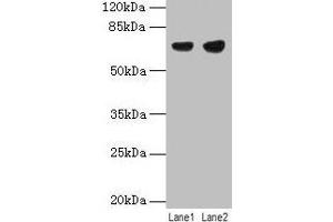 Western blot All lanes: PTPN6 antibody at 12 μg/mL Lane 1: Jurkat whole cell lysate Lane 2: Raji whole cell lysate Secondary Goat polyclonal to rabbit IgG at 1/10000 dilution Predicted band size: 68, 64, 71 kDa Observed band size: 68 kDa (SHP1 Antikörper  (Isoform 2))
