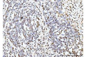 IHC analysis of ARL6IP6 using anti-ARL6IP6 antibody (ABIN7603020). (ARL6IP6 Antikörper  (Middle Region))