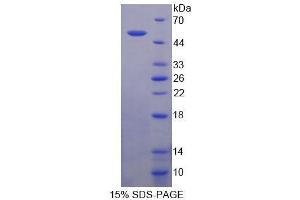 SDS-PAGE analysis of Human SECTM1 Protein. (SECTM1 Protein)