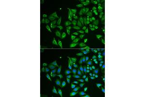 Immunofluorescence analysis of HeLa cells using CLEC3B/Tetranectin antibody (ABIN6130014, ABIN6138710, ABIN6138712 and ABIN6222056). (CLEC3B Antikörper  (AA 22-202))