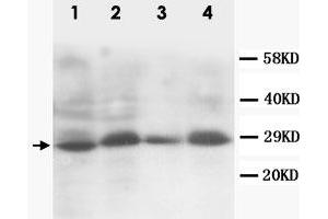 Western Blot analysis of SSX2 expression from cell extracts with SSX2 polyclonal antibody . (SSX2 Antikörper  (C-Term))