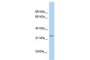 KHK antibody used at 1 ug/ml to detect target protein. (Ketohexokinase Antikörper)