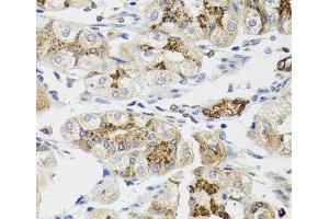 Immunohistochemistry of paraffin-embedded Human stomach using LFNG Polyclonal Antibody at dilution of 1:100 (40x lens). (LFNG Antikörper)