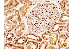 Immunohistochemistry (IHC) image for anti-serpin Peptidase Inhibitor, Clade A (Alpha-1 Antiproteinase, Antitrypsin), Member 6 (SERPINA6) (AA 23-405) antibody (ABIN7148621)