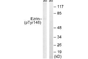 Western blot analysis of extracts from 293 cells, treated with UV (15mins), using Ezrin (Phospho-Tyr146) antibody. (Ezrin Antikörper  (pTyr146))
