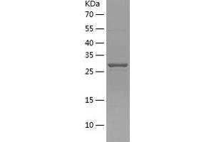 Western Blotting (WB) image for Acyl-CoA Binding Domain Containing 6 (ACBD6) (AA 1-282) protein (His tag) (ABIN7121676)