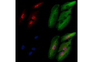 ABIN6259213 and ABIN6273534 staining  cells by IF/ICC.