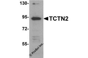 Western Blotting (WB) image for anti-Tectonic Family Member 2 (TCTN2) (C-Term) antibody (ABIN1030725) (TCTN2 Antikörper  (C-Term))