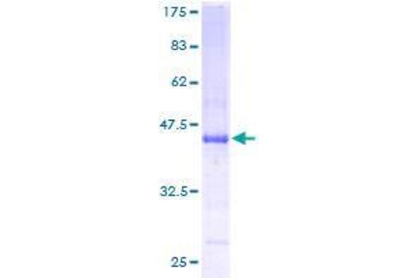 ATRAID Protein (AA 1-171) (GST tag)