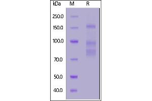 SARS-CoV-2 S protein, His Tag on  under reducing (R) condition. (SARS-CoV-2 Spike Protein (His tag))