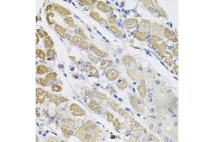 Immunohistochemistry of paraffin-embedded human stomach using SDC2 antibody at dilution of 1:100 (x40 lens). (Syndecan 2 Antikörper)