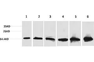 Western blot analysis of 1) Hela, 2) 293T, 3) 3T3, 4) Mouse Liver tissue, 5) Rat Liver tissue, 6) Rat Kidney tissue using CYCS Monoclonal Antibody. (Cytochrome C Antikörper)