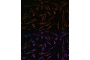 Immunofluorescence (IF) image for anti-Ribosomal Protein S6 Kinase, 90kDa, Polypeptide 1 (RPS6KA1) (C-Term) antibody (ABIN7270035)