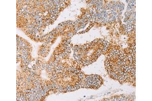 Immunohistochemistry (IHC) image for anti-Tyrosyl-tRNA Synthetase 2, Mitochondrial (YARS2) antibody (ABIN2422815) (YARS2 Antikörper)