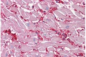 Human Heart: Formalin-Fixed, Paraffin-Embedded (FFPE) (ENO1 Antikörper  (AA 1-435))