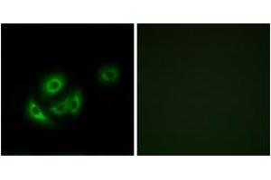 Immunofluorescence analysis of A549 cells, using MRPL11 Antibody. (MRPL11 Antikörper  (AA 21-70))