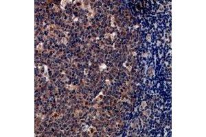 Immunohistochemical analysis of Tryptase delta staining in human tonsil formalin fixed paraffin embedded tissue section. (TPSD1 Antikörper)