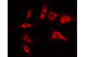 ABIN6274403 staining COLO205 cells by IF/ICC. (DOK6 Antikörper  (Internal Region))