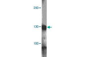Western blot analysis of RC3H1 in HeLa cell lysate with RC3H1 polyclonal antibody  at 1 ug/mL. (RC3H1 Antikörper  (AA 1040-1090))