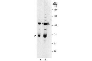 Western blot analysis of HPGD in LoVo whole cell lysates using HPGD polyclonal antibody . (HPGD Antikörper)
