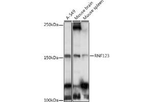 Western blot analysis of extracts of various cell lines, using RNF123 antibody (ABIN6129118, ABIN6147005, ABIN6147006 and ABIN6223534) at 1:1000 dilution.