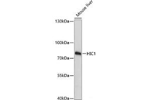 Western blot analysis of extracts of Mouse liver using HIC1 Polyclonal Antibody at dilution of 1:3000. (HIC1 Antikörper)