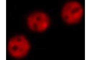 ABIN6274105 staining Hela by IF/ICC. (AKAP8 Antikörper  (Internal Region))