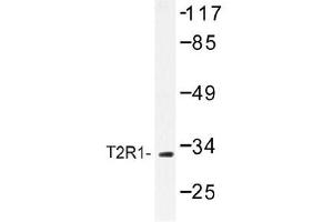 Image no. 1 for anti-Taste Receptor, Type 2, Member 1 (TAS2R1) antibody (ABIN317775) (TAS2R1 Antikörper)