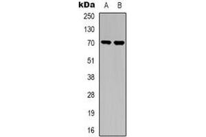 Western blot analysis of TGFBR2 expression in A549 (A), NIH3T3 (B) whole cell lysates. (TGFBR2 Antikörper)