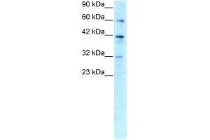 WB Suggested Anti-E2F4 Antibody Titration: 0. (E2F4 Antikörper  (C-Term))