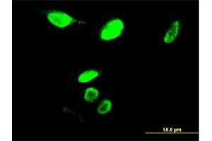 Immunofluorescence of monoclonal antibody to MYBL2 on HeLa cell. (MYBL2 Antikörper  (AA 601-700))